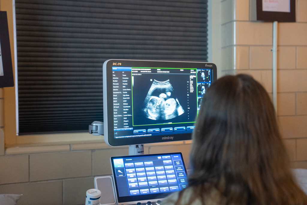 NSU sonography student reads data on ultrasound screen